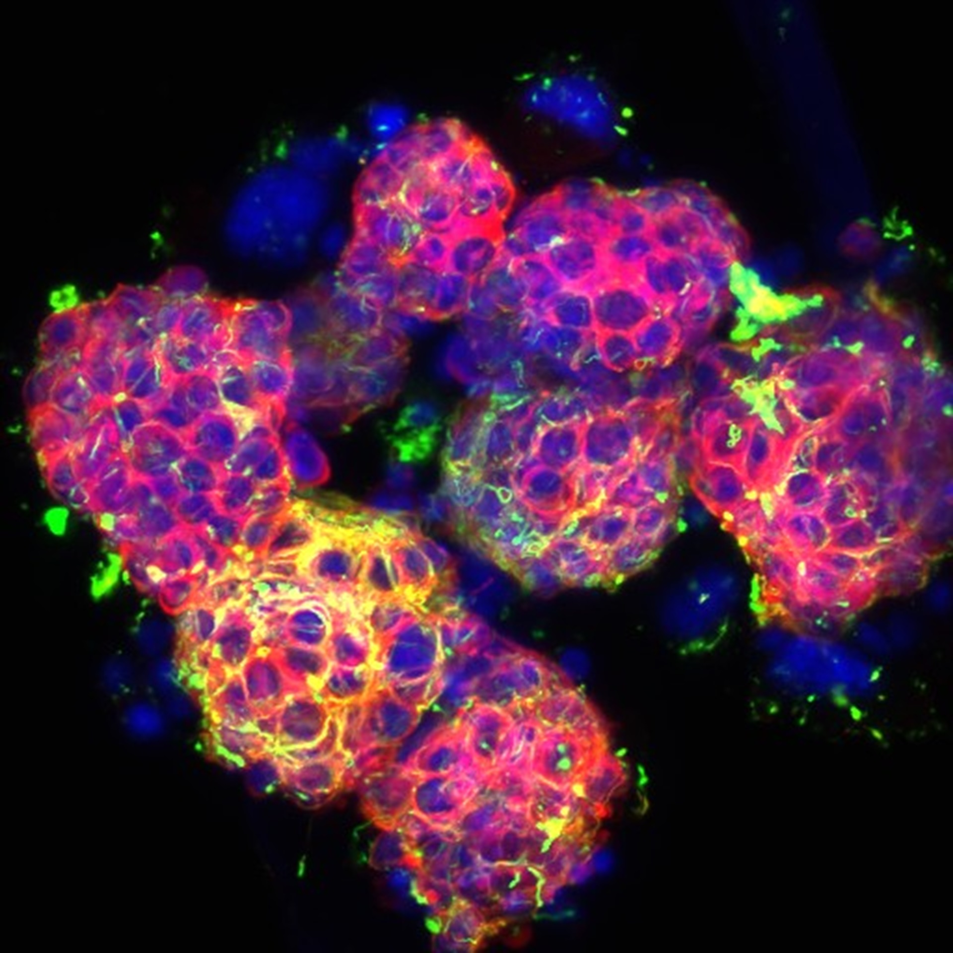 Ex-vivo culture of bone marrow from chemotherapy-resistant mice harbouring metastatic neuroblastoma cells – one of the most common and difficult to treat childhood cancers.