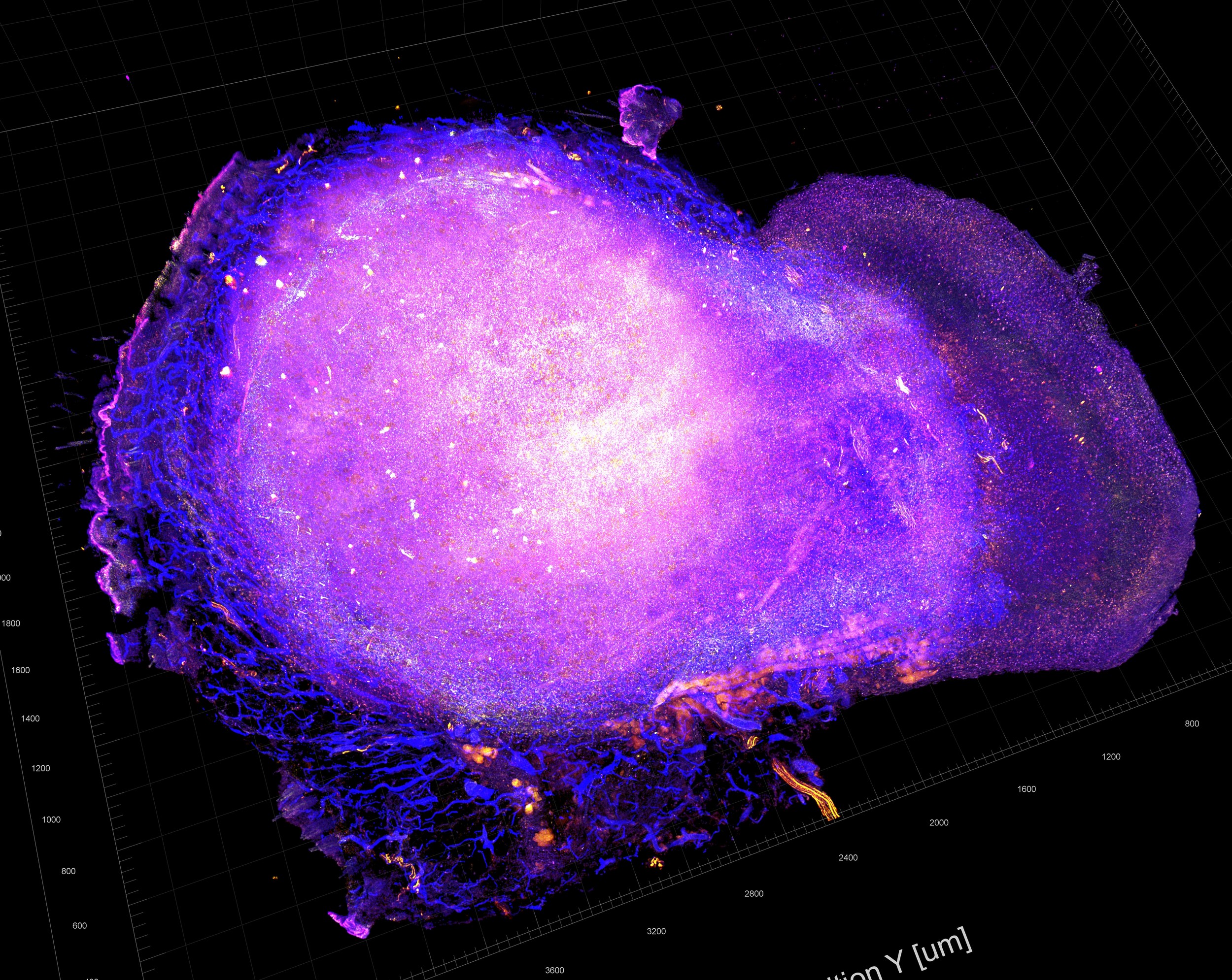 Anti-Tumor Immune Response. Source: National Cancer Institute \ Univ. of Chicago Comprehensive Cancer Center