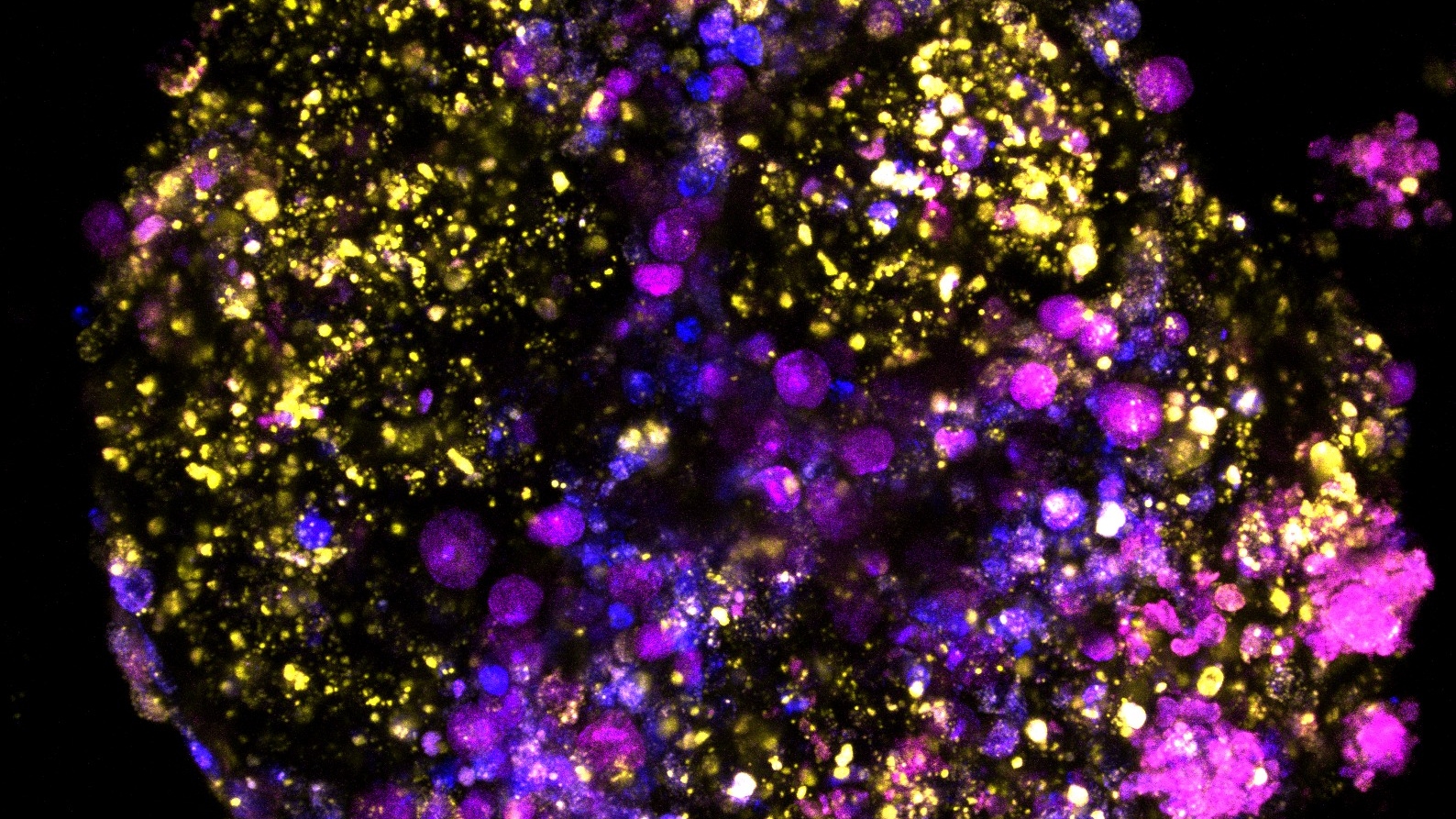 Bowel tumour organoids An image of bowel tumour organoids on a black background