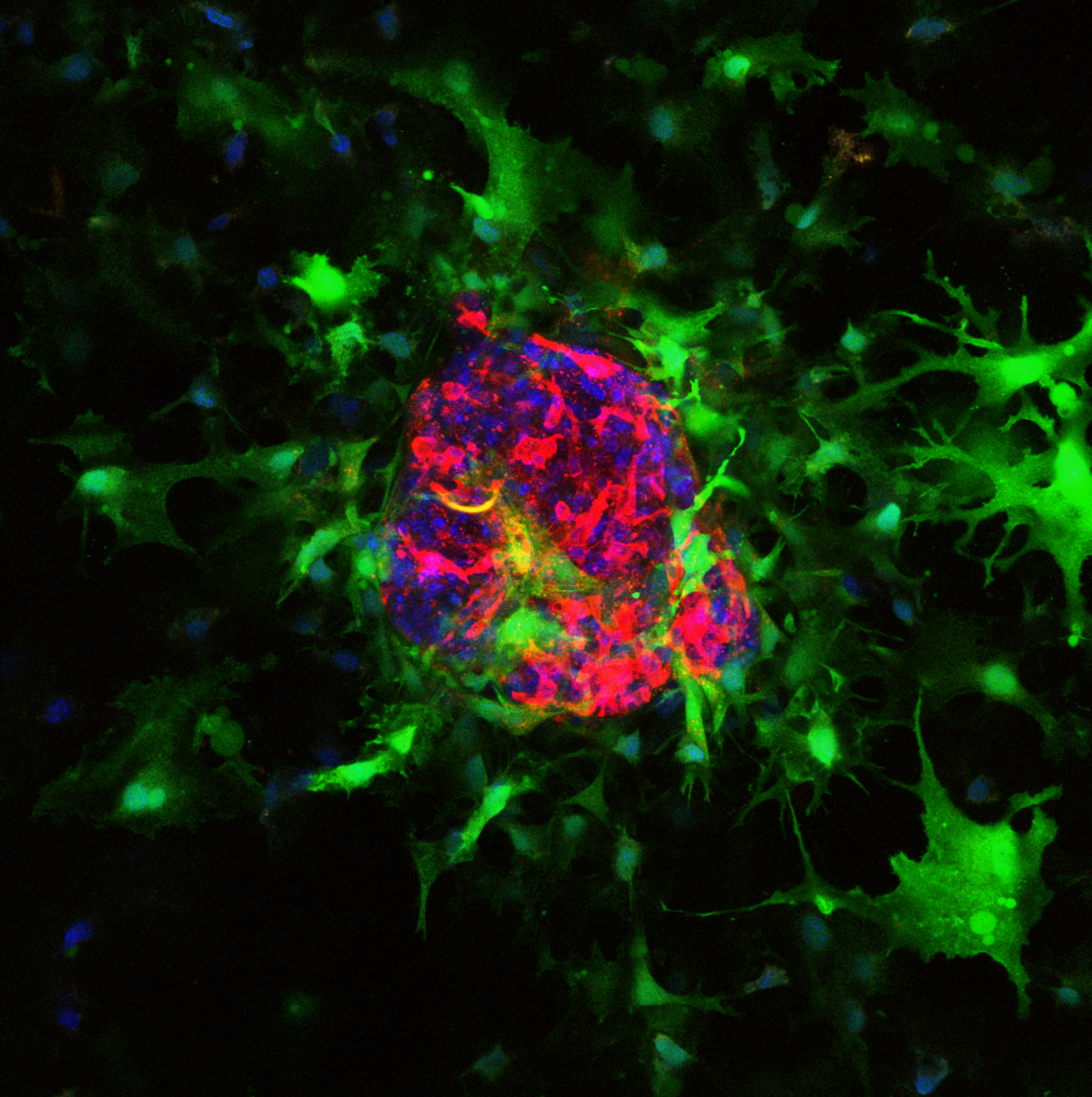 3D image of a tumour coculture model