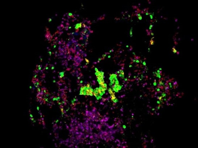 Biomarkers immunofluorescence