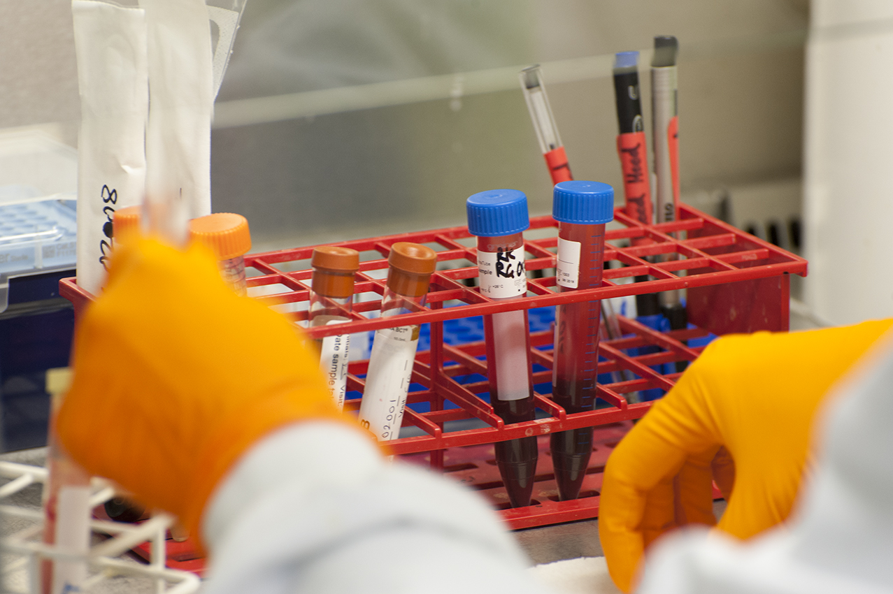Gloved hands arranging test tubes containing blood in a test-tube rack in a lab