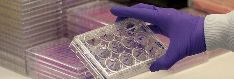 Researcher wearing latex gloves holding up a cell culture plate