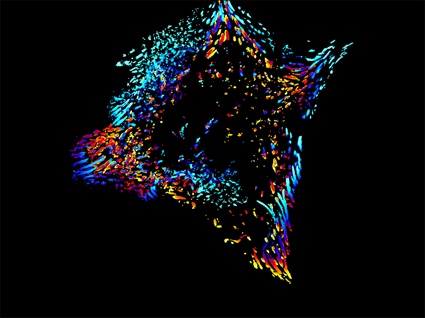 Patricia Pascual Vargas - Time lapse image of an aggressive breast cancer cell sensing its environment through focal adhesions 945x709px