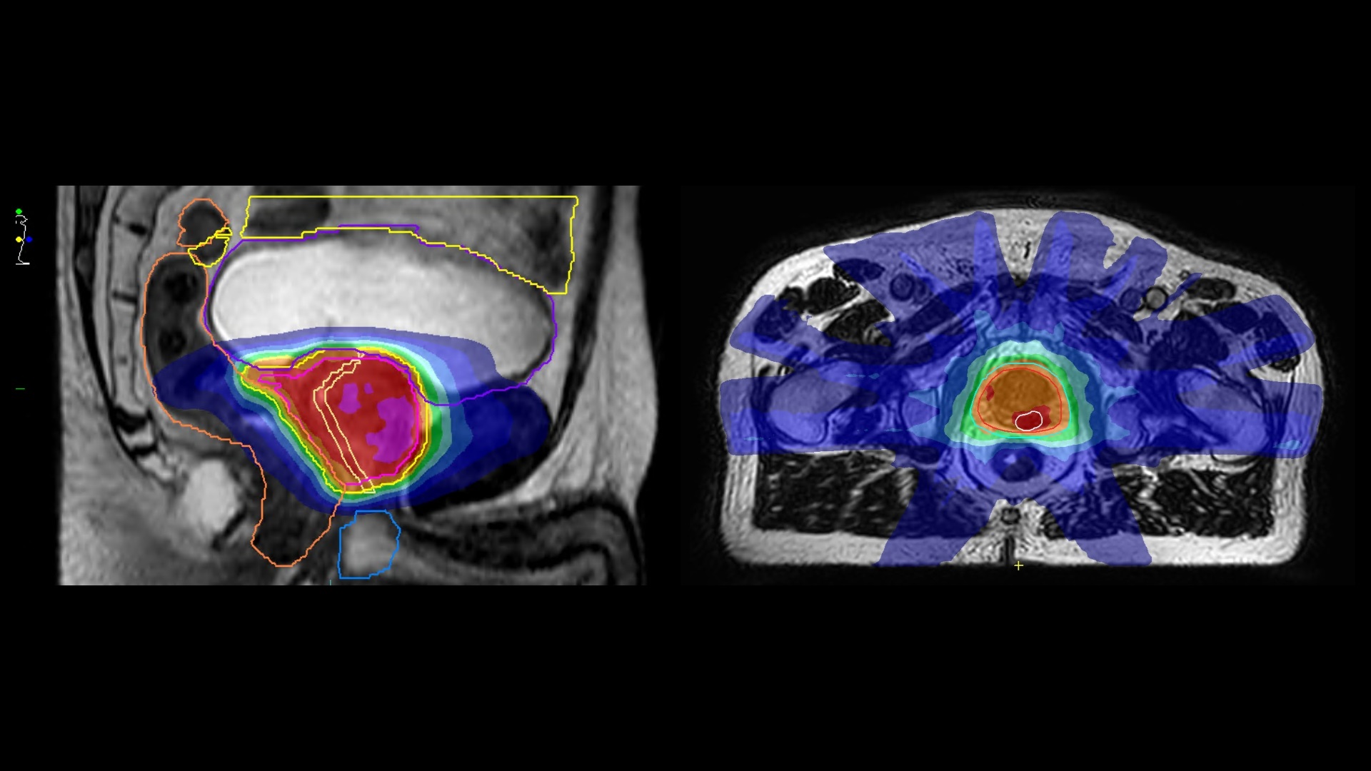 MRI scan, axial and sagittal view