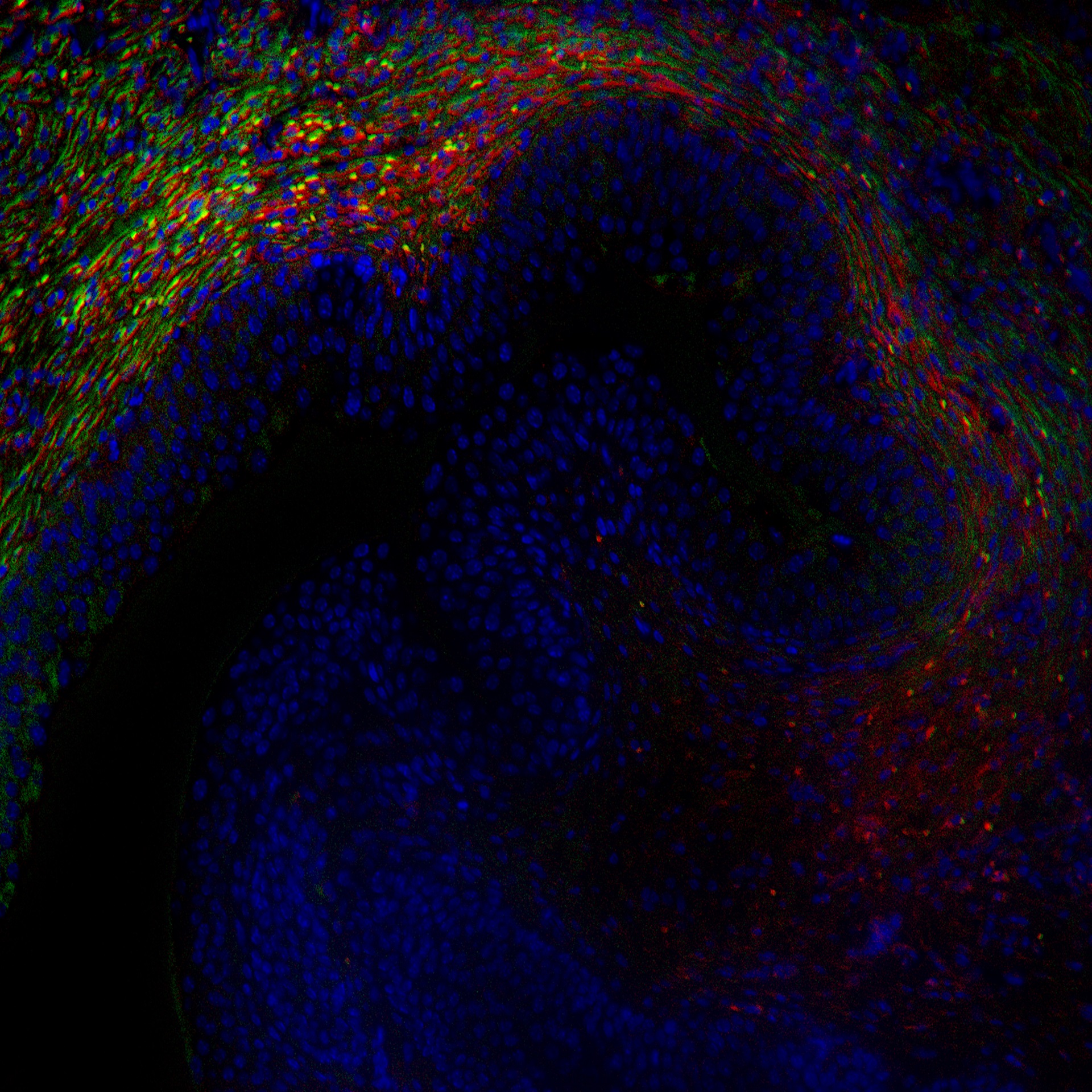 Microscope image of bladder cells, showing rainbow colours