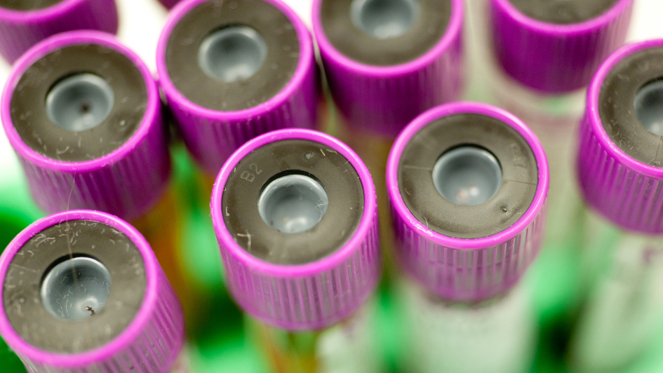 Myeloma Timeline_2000s Blood samples in tubes with purple lids