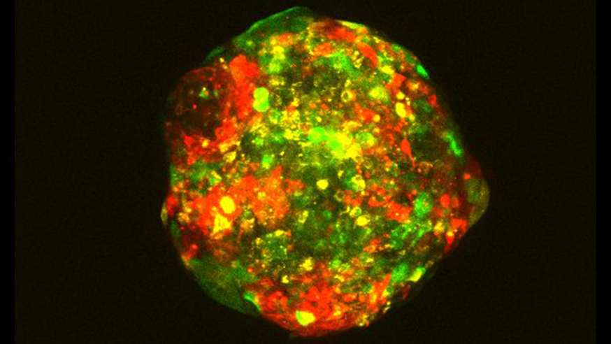 A multicellular spheroid that contains three distinct cell line clones from the MCF10 progression series. The three clones are stained with CellTracker dyes (Red, Green and Yellow) and the image was taken with the Zeiss confocal.