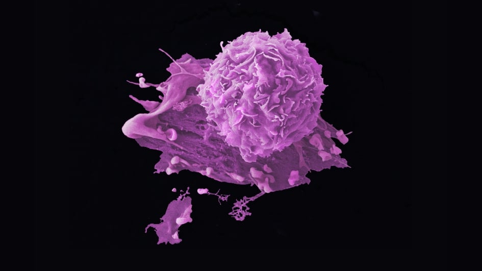 Breast cancer cells on a black background