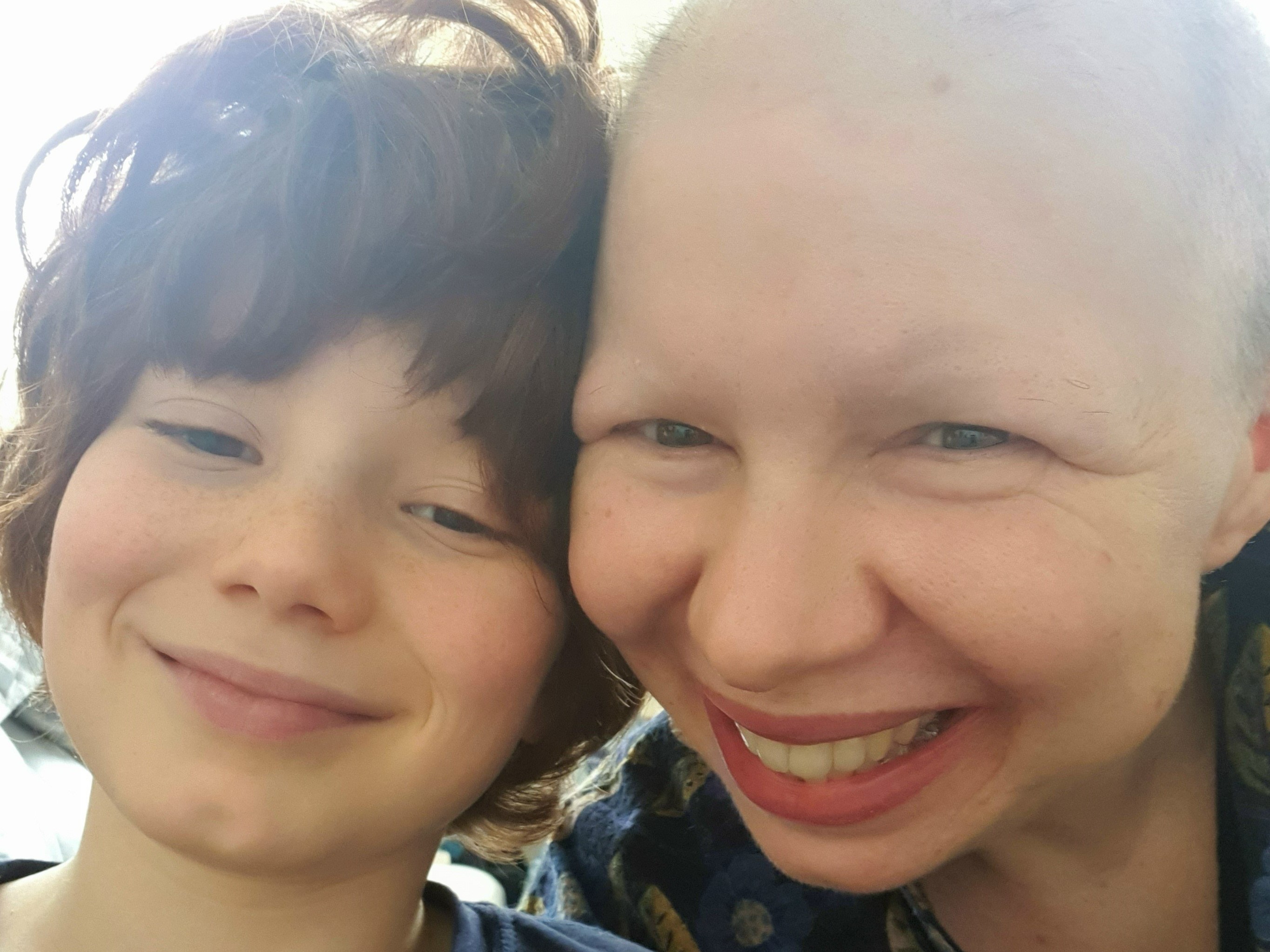 Close up shot of Annie with her son. Both are smiling. Annie's had chemotherapy and has lost her hair