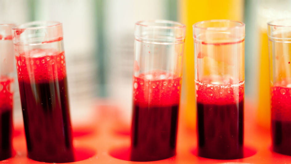 Blood samples in tubes