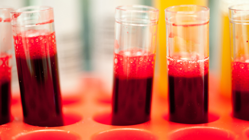 Blood samples in tubes