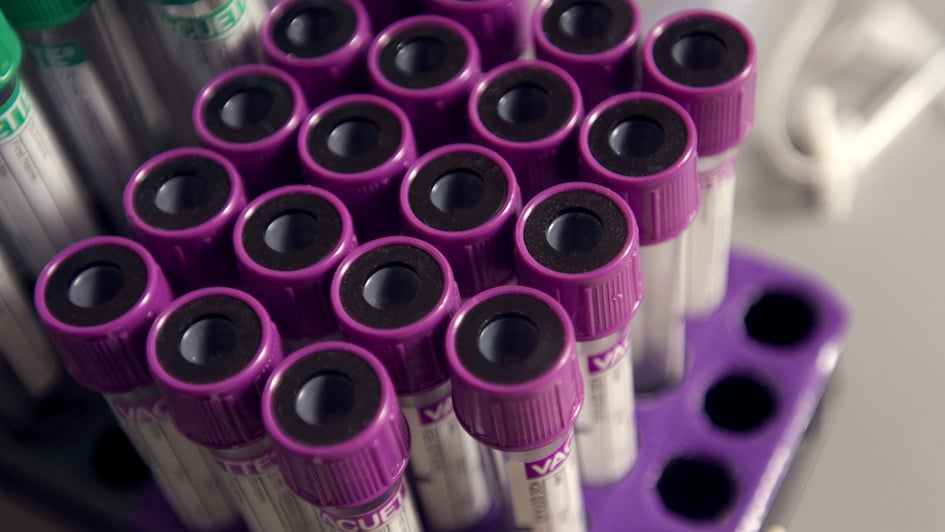 test tubes filled with blood samples