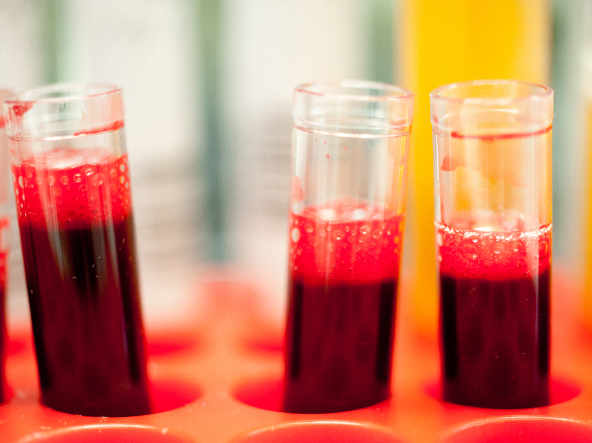 BloodSampleTestTubes BloodSampleTestTubes