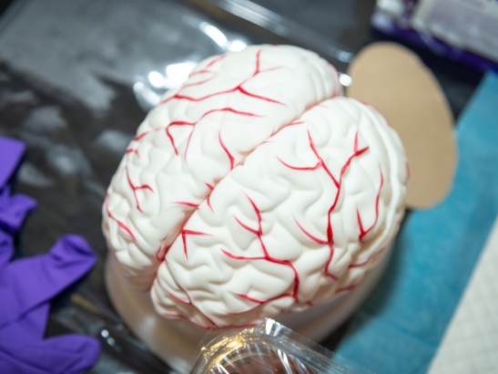 A brain model