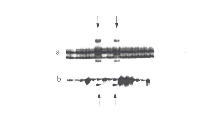 BRCA2 gene