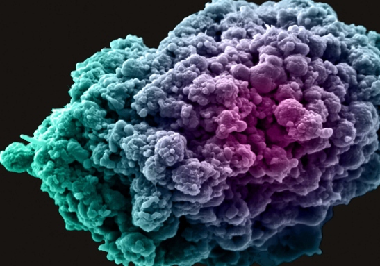 breast cancer cell 547 x 383