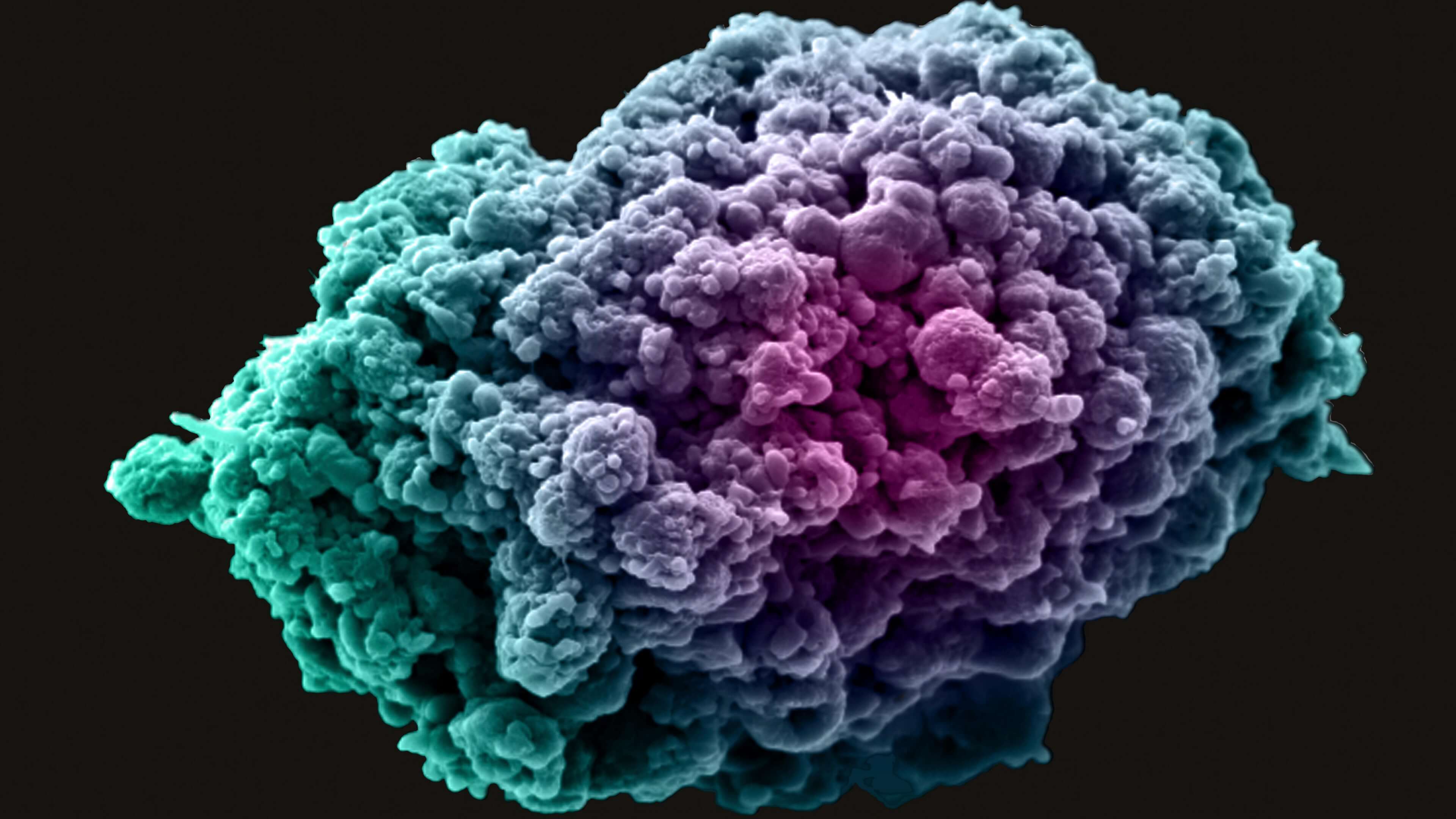 Breast cancer cell spheroid blue and purple