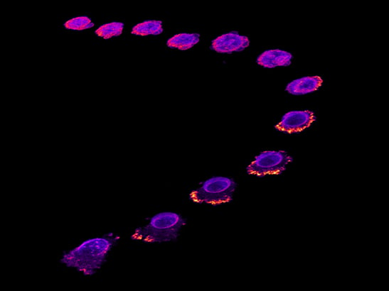 Breast cancer cell timelapse