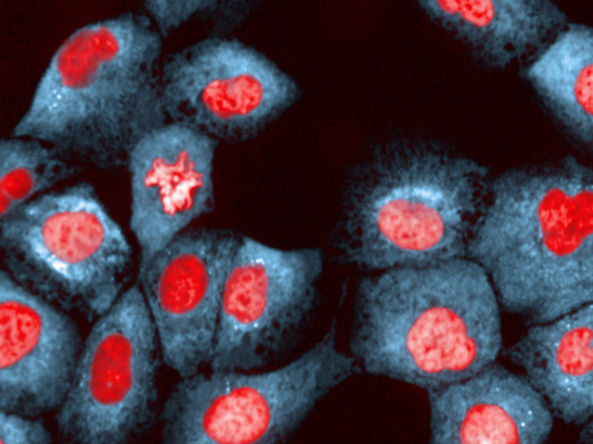 Breast epithelial cells under ER stress (Chris Bakal, 2014)