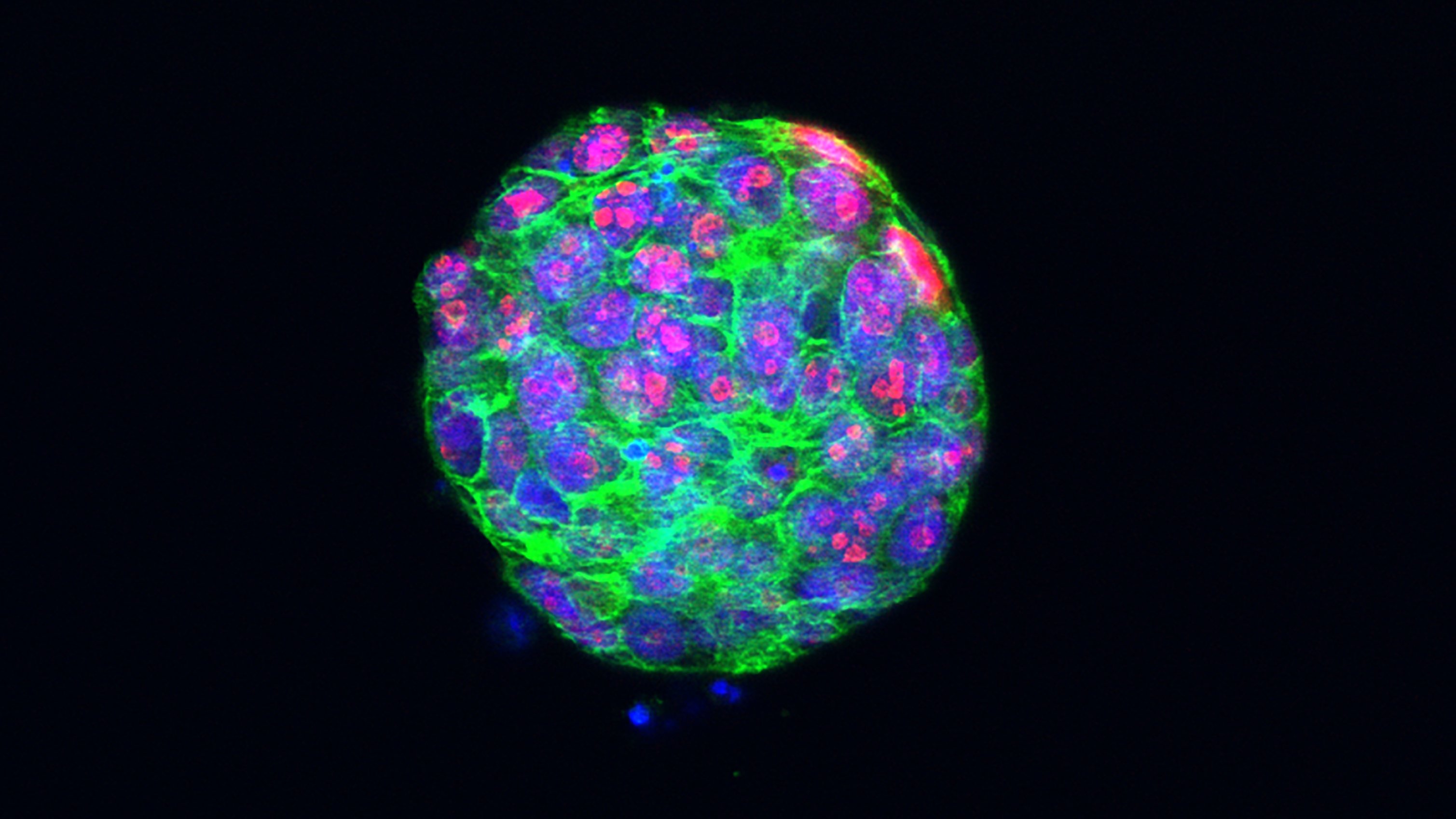 Breast cancer organoid