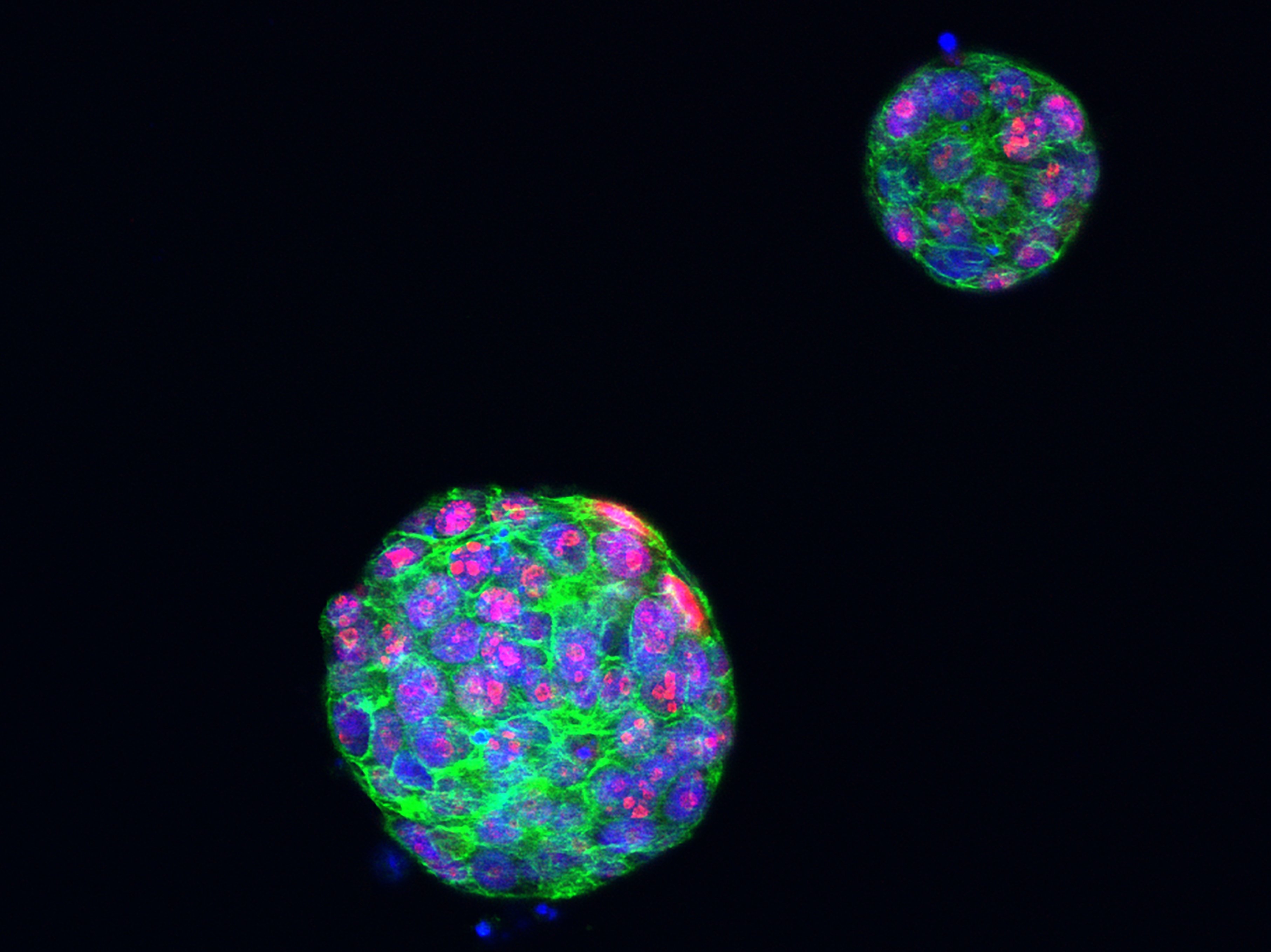 Breast cancer organoid