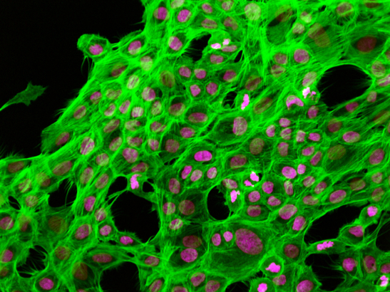 Breast epithelial cells stained for DNA (magenta) and actin (green). Julia Sero / the ICR, 2011