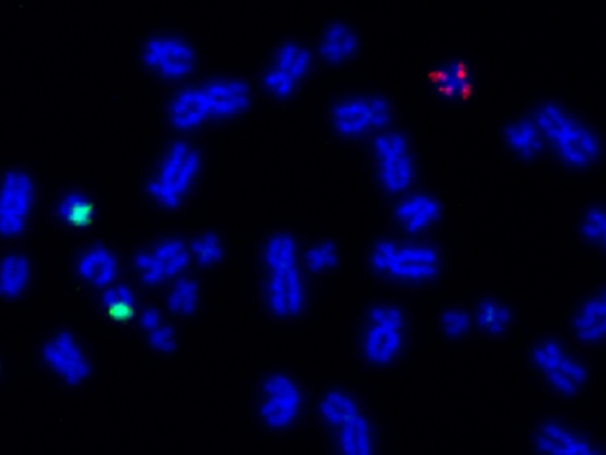 Microscope image of chromosomes