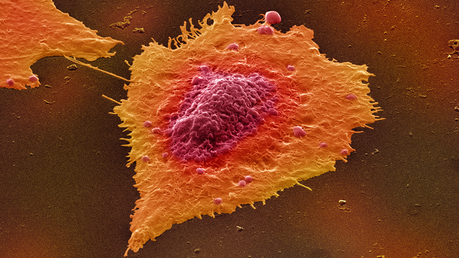 Colour-enhanced image of human colon cancer cells in culture 945x532px