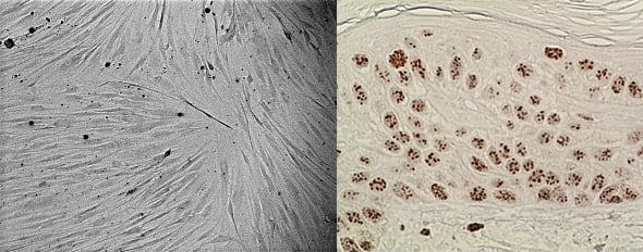 Combined image of fibroblasts (left) and cells stained for p53-binding protein 1