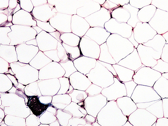 Connective tissue adipose 547x410px