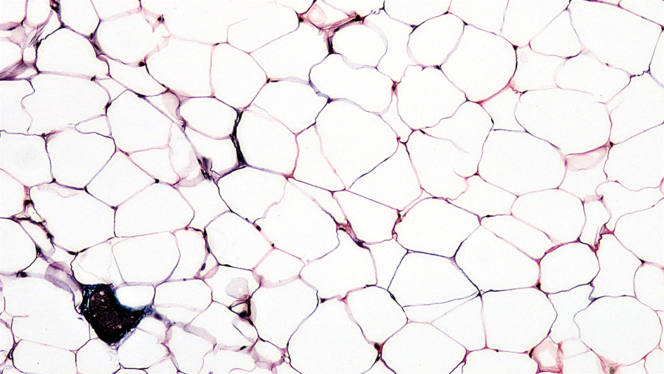 Connective tissue adipose 945x532px