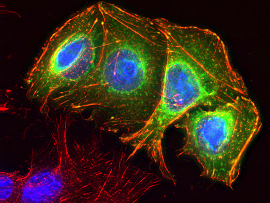 Cultured colon cancer cells