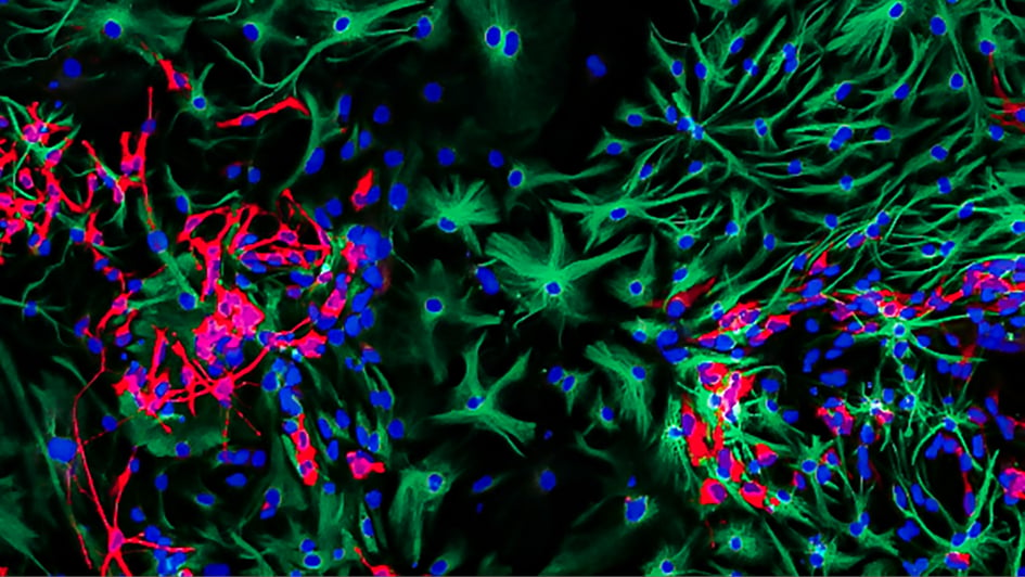 Differentiating brain cancer cells