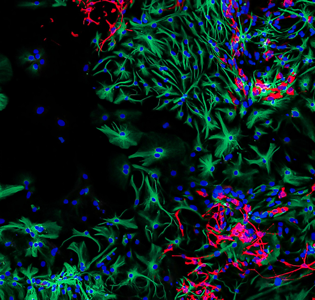 Differentiating brain cancer cells by PhD student Sumana Shrestha