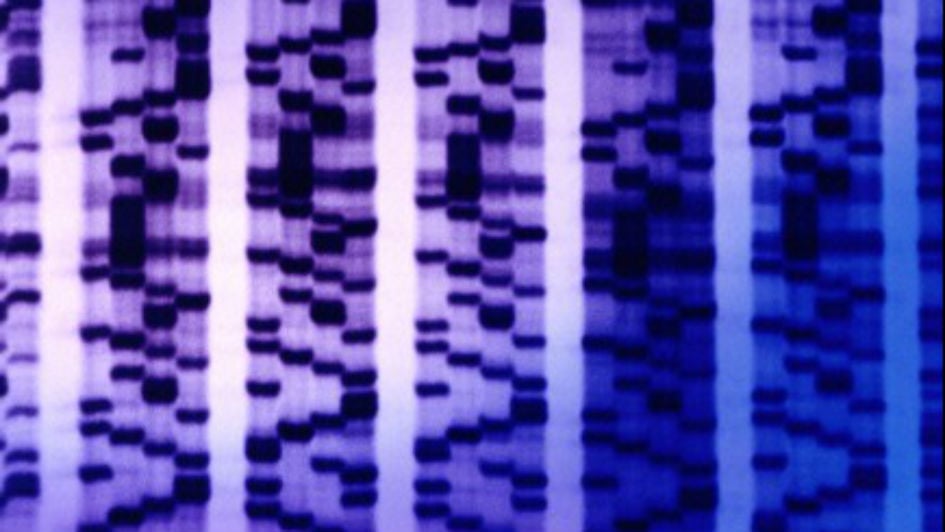 DNA array