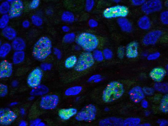 Image showing double-stranded DNA repair following radiation in breast tumours (photo: Frances Daley/Dave Robertson)