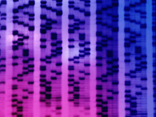 DNA sequencing autoradiograph - coloured