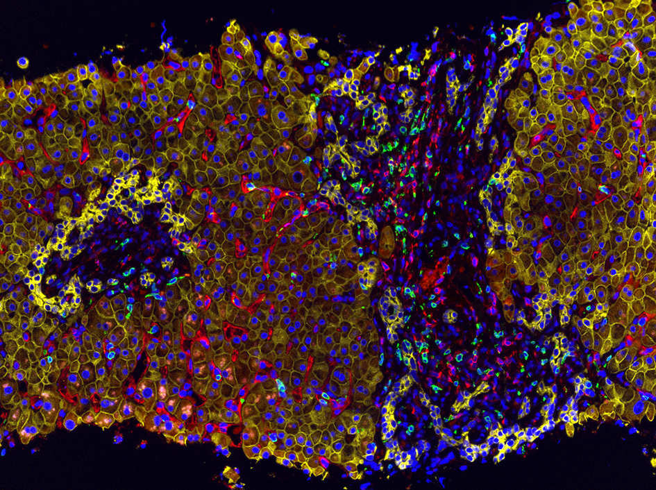 Dr Mateus Crespo - Detecting T-Cells in biopsies and healthy tissue 945x706px