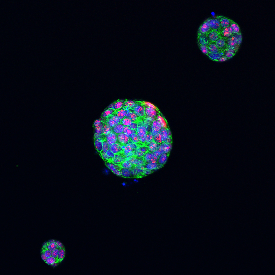 Dr Rebecca Marlow - Proliferating cells in a tumour organoid of triple-negative breast cancer 945x945px