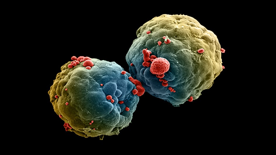 False-coloured scanning electron micrograph (SEM) of a 3-day old breast tumour spheroid 945x532px