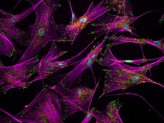 Fibroblasts - Ankur Singh, Georgia Tech