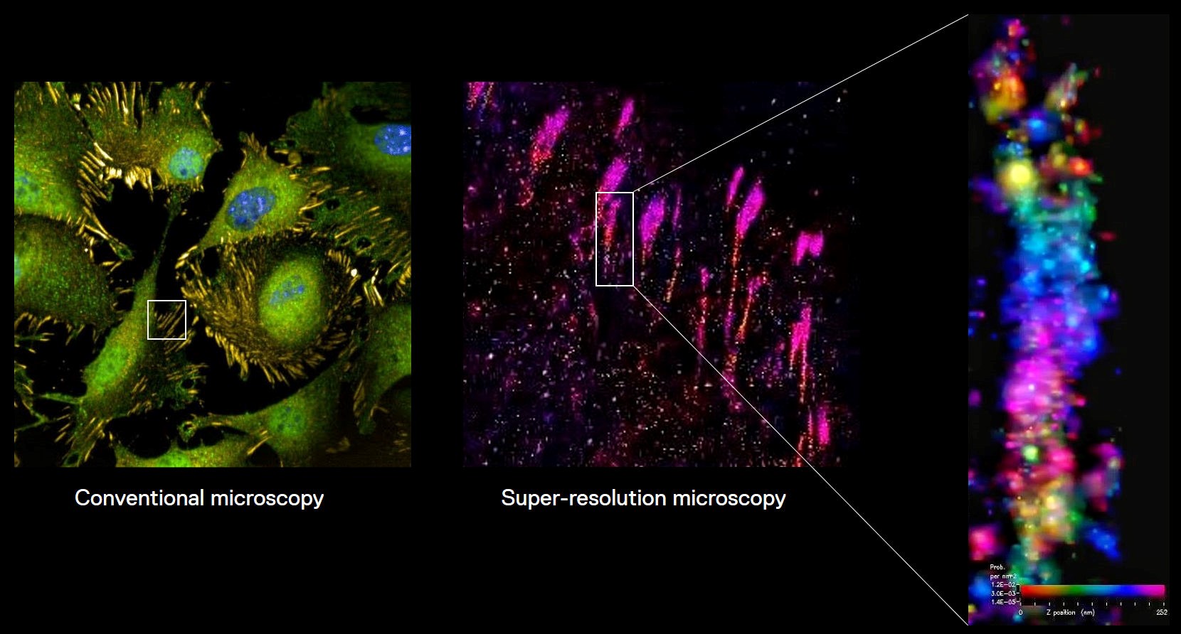 Super-resolution microscopy images of focal adhesions on cancer cells, compared with images taken using standard microscopy techniques