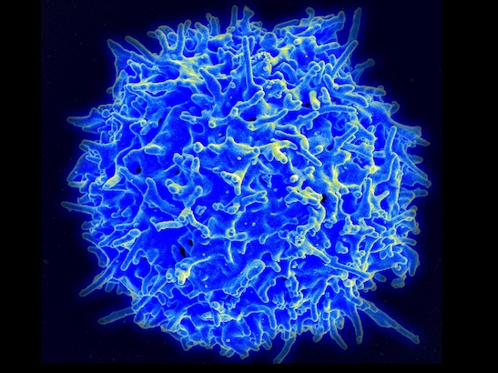 Scanning electron micrograph of a human T lymphocyte (also called a T cell) from the immune system of a healthy donor. Credit: NIAID