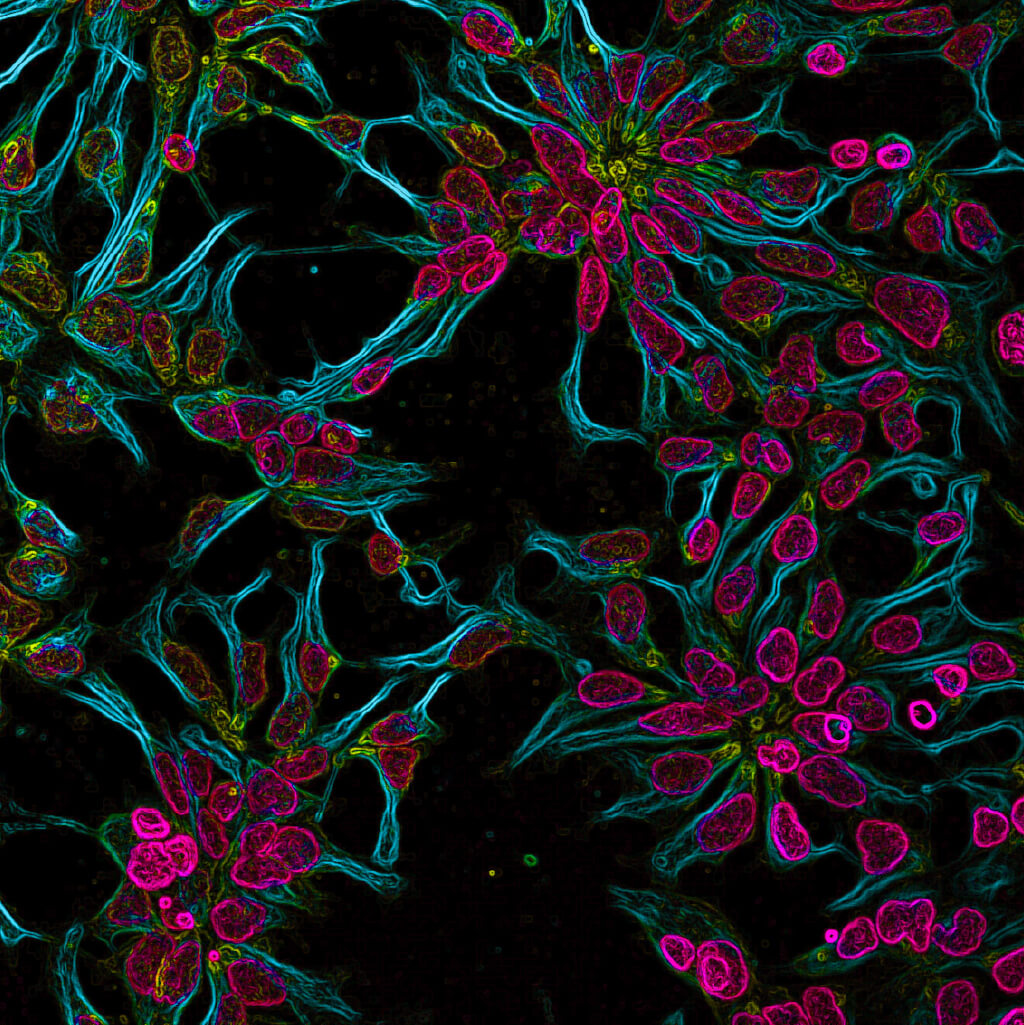 Neural rosette structures in human stem cells - precursors to our developing brain cells by Sumana Shrestha