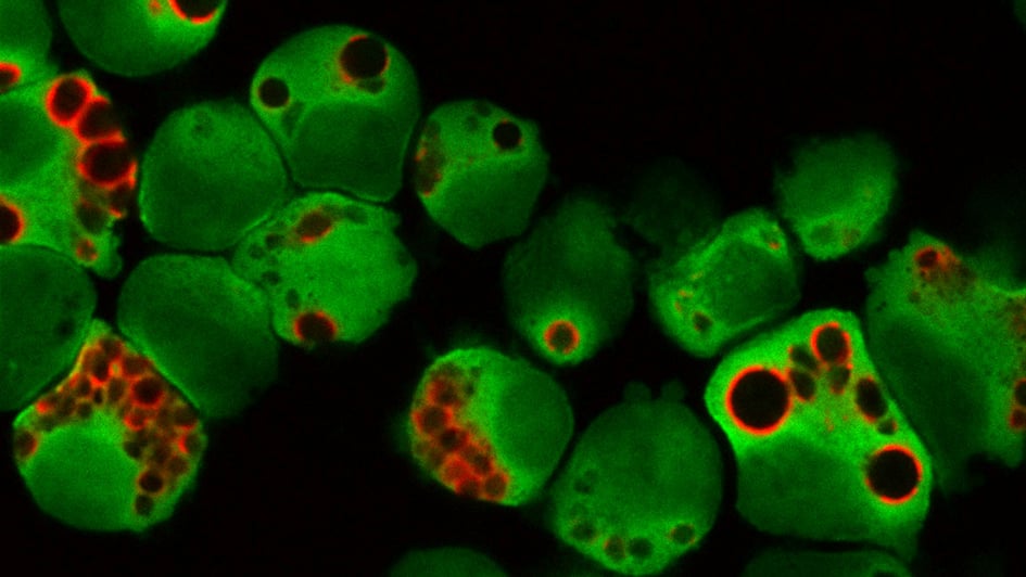 Immunofluorescent image of autophagosomes in multiple myeloma cells 945x532px