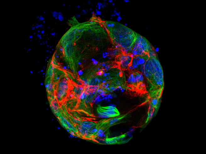 Intestinal organoid crop