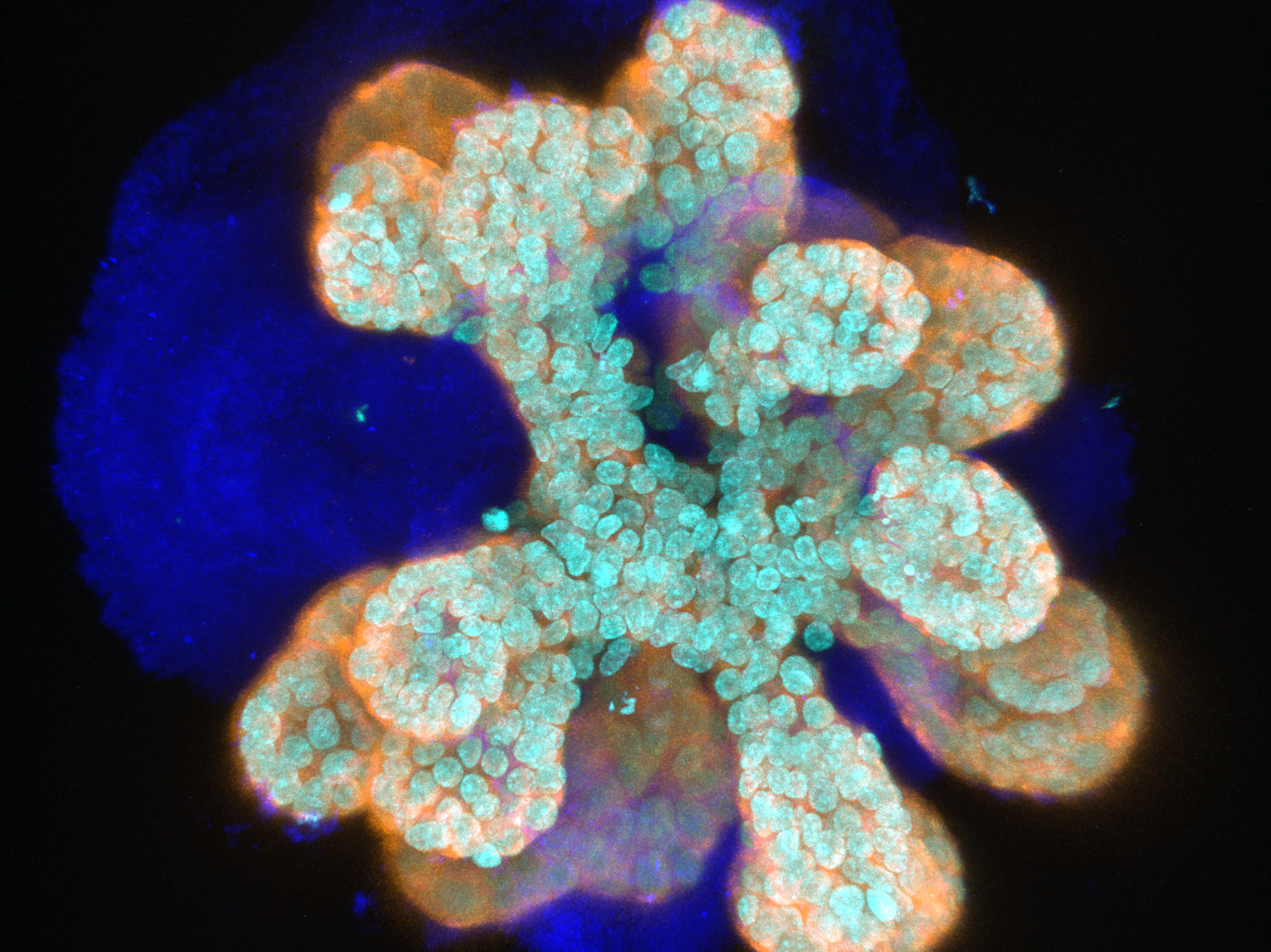 Mammary organoid