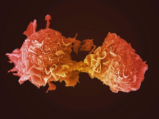 lung-cancer-cells-dividing-547x411px