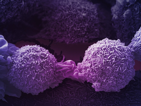 Purple lung cancer cells